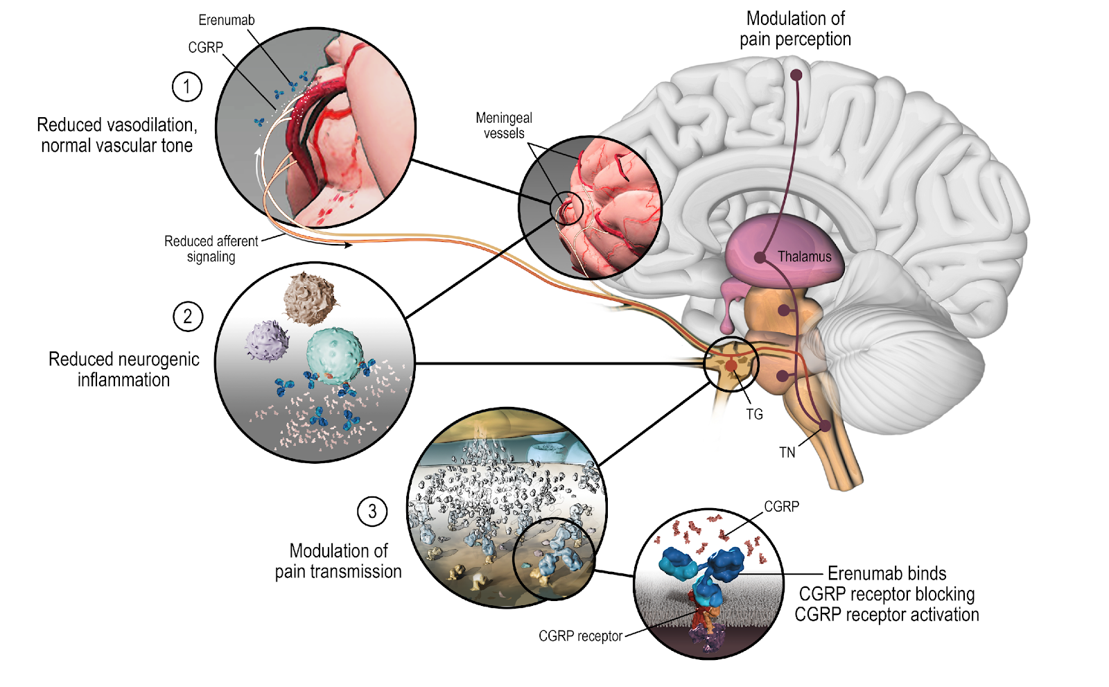 Diagram of where CGRP is found in a migraine attack.
